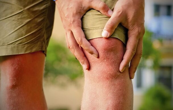 Klinisches Bild der Arthrose