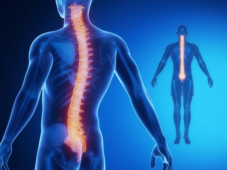 Osteochondrose der Wirbelsäule, die eine komplexe Behandlung erfordert