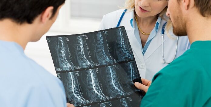 Röntgen der Wirbelsäule als Methode zur Diagnose von Osteochondrose
